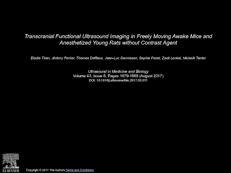 Transcranial Functional Ultrasound Imaging in Freely Moving Awake Mice and