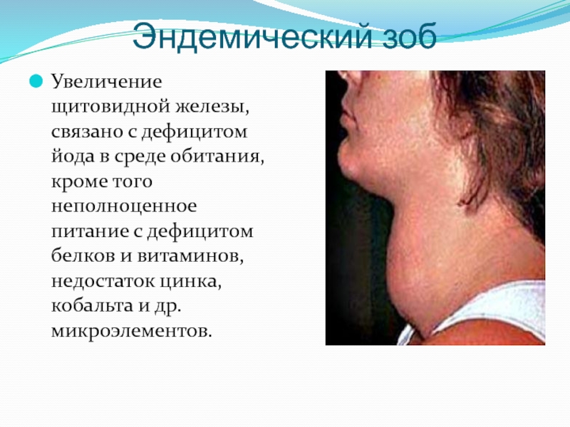 Диета При Зобе Щитовидной Железы