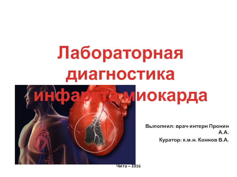 Чита – 2016
Лабораторная диагностика
инфаркта миокарда
ГБОУ ВПО Читинская