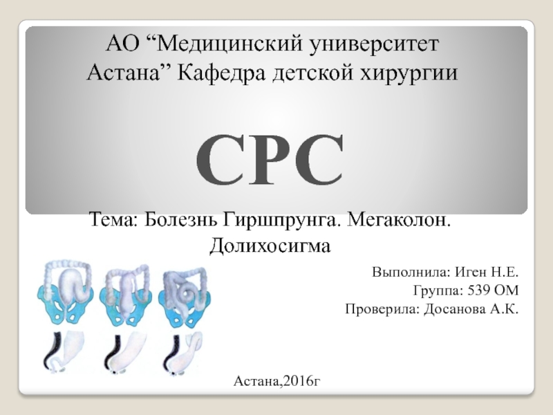 АО “ М едицинский университет Астана ” Кафедра детской хирургии
СРС
Тема: