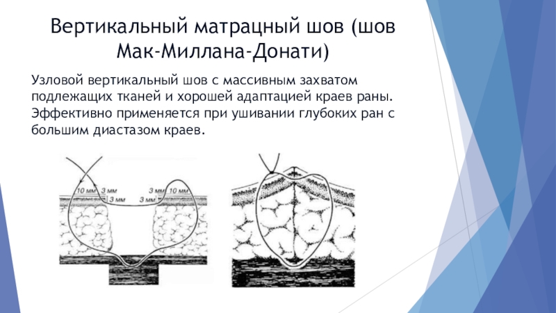 Шов Шов Интернет Магазин Распродажа