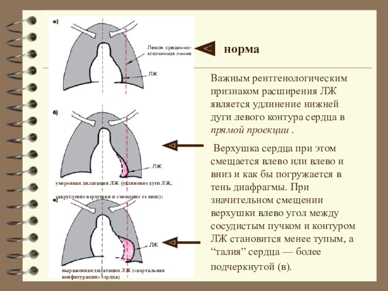 Понятие о дугах сердца рисунок