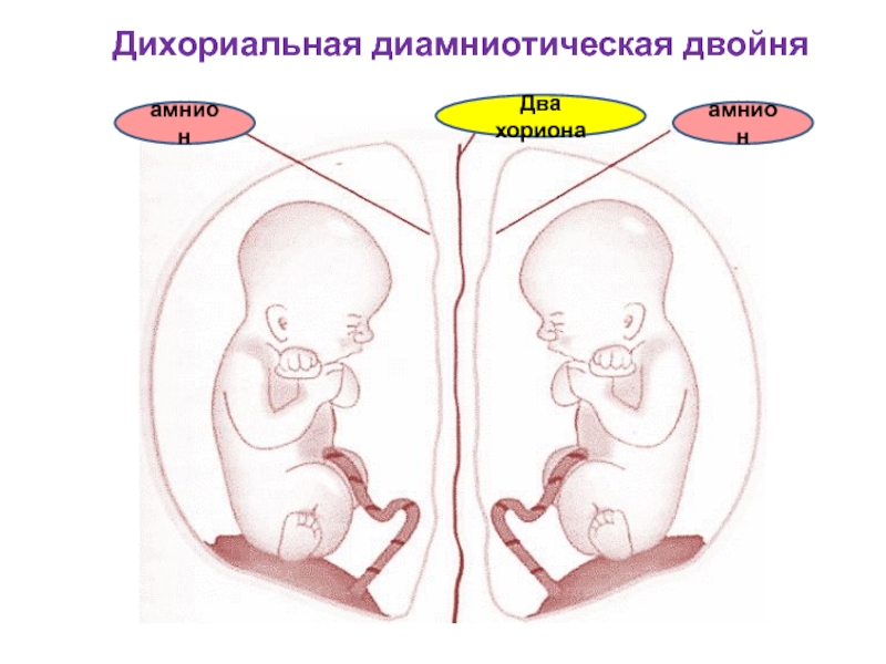 Чудо в животике: многоплодная беременность.