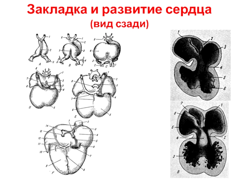 Типы сердец. Развитие и аномалии развития сердца. Пороки развития сердца схема. Порок развития сердца лекция.