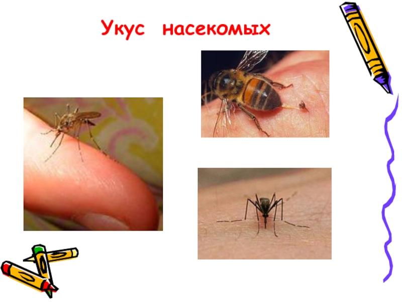 Укусы насекомых рисунок