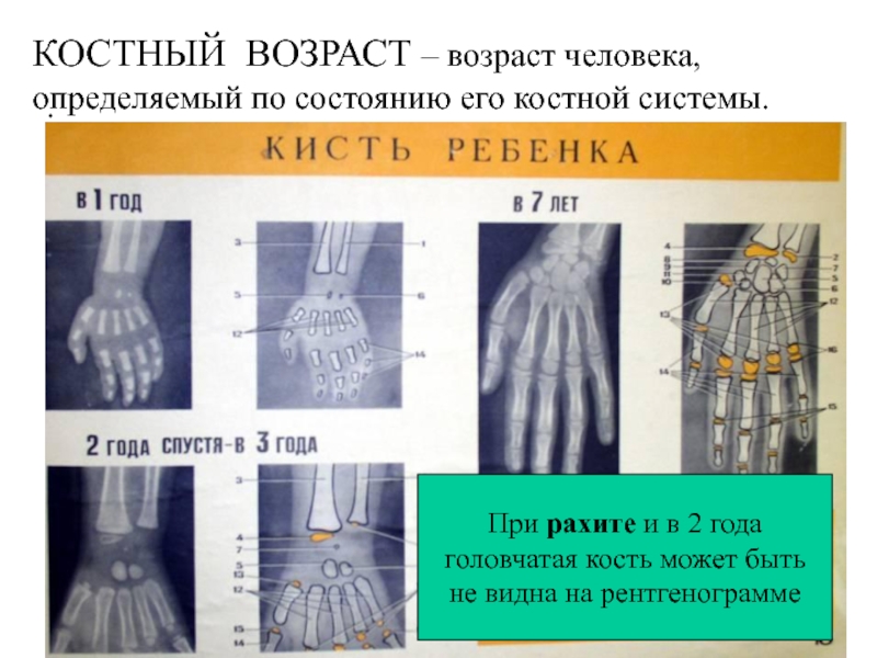 Костный возраст фото