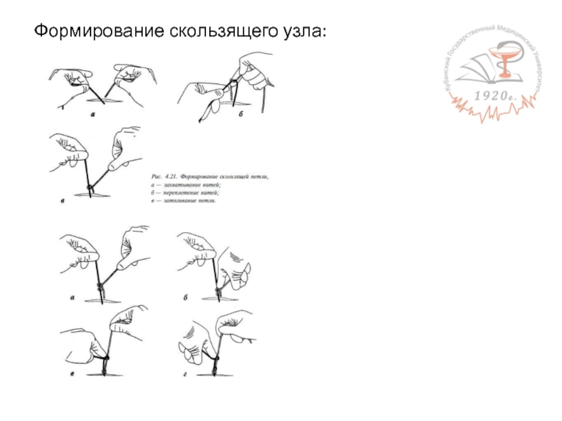 Формирование 6. Седельный шов с узлом схема. Седельный шов с узлом. Формирование скольжения. Узел на нитке седельный шов чертеж.