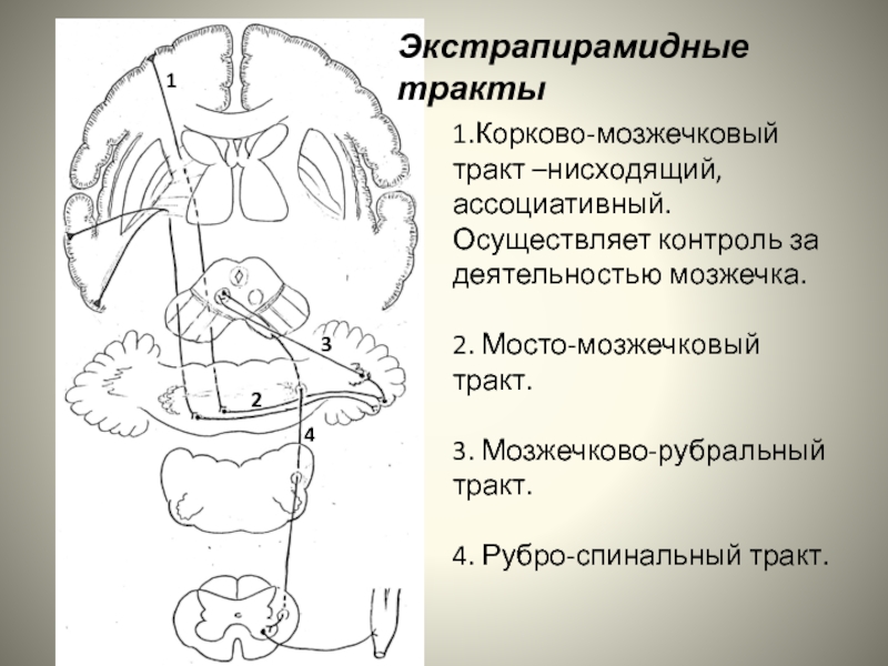 Мосто мозжечковый синдром