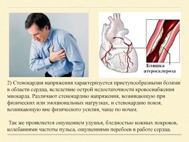 Области ишемии. Ишемическая болезнь сердца презентация. Ишемическая болезнь сердца доклад. Ишемическая болезнь сердца картинки для презентации. Ишемическая болезнь сердца операция.