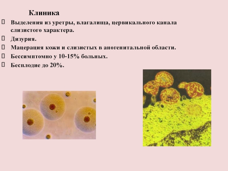 Выделения из уретры фото