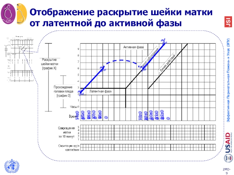 Партограмма в акушерстве образец