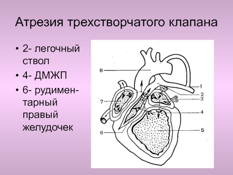 Легочный ствол выходит из