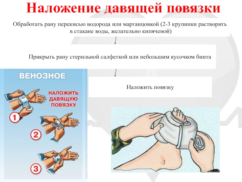 Презентация на тему оказание первой медицинской помощи при кровотечениях