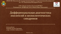 Дифференциальная диагностика эпилепсий и неэпилептических синдромов