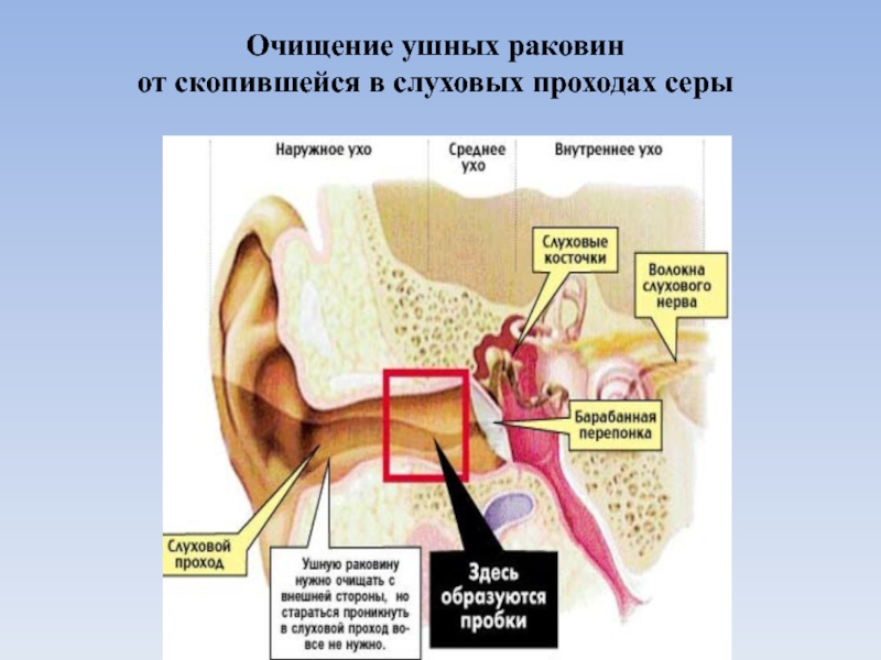 Можно ли перекись в ухо ребенку. Очищение ушной раковины и слухового прохода. Перекись водорода в ухе. Реакция ушной серы с перекисью водорода.