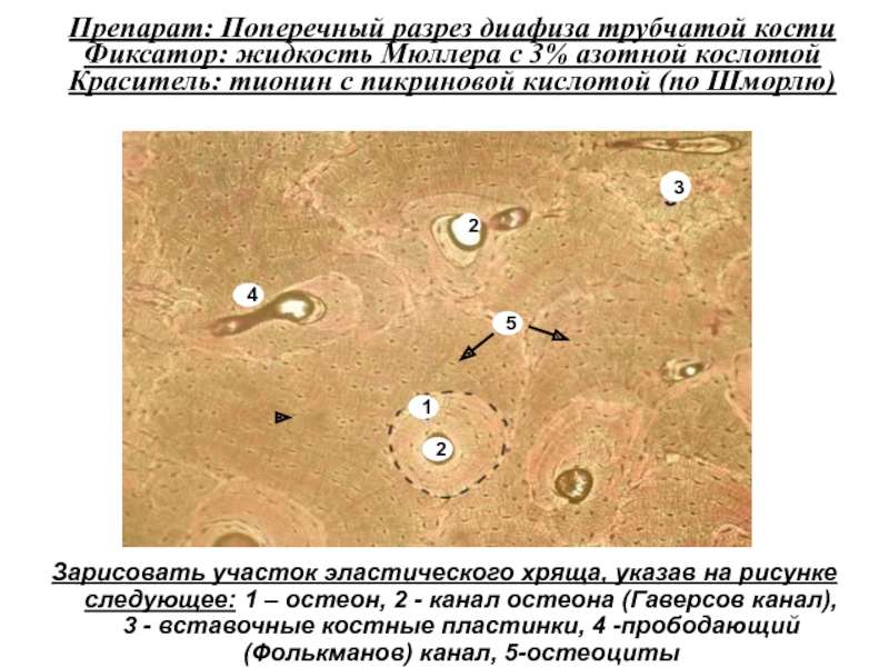 Пластинчатая костная ткань гистология рисунок