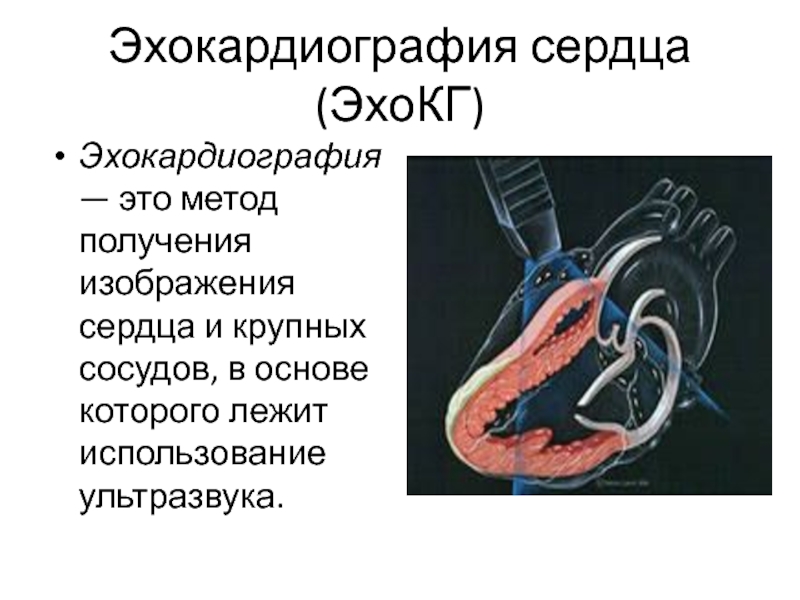 Эхокардиография что это за обследование. Эхокардиография суть метода. УЗИ сердца (эхокардиография). Эхокардиография принцип метода. Эхокардиография сосудов сердца.