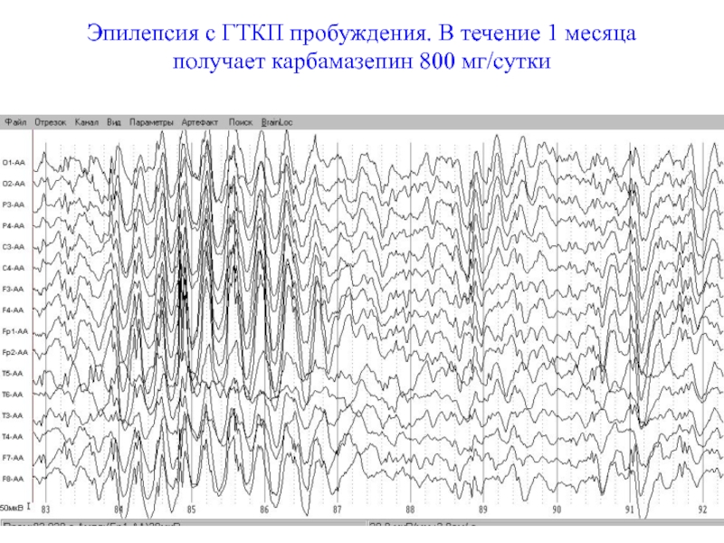 Учебный план электроэнцефалография