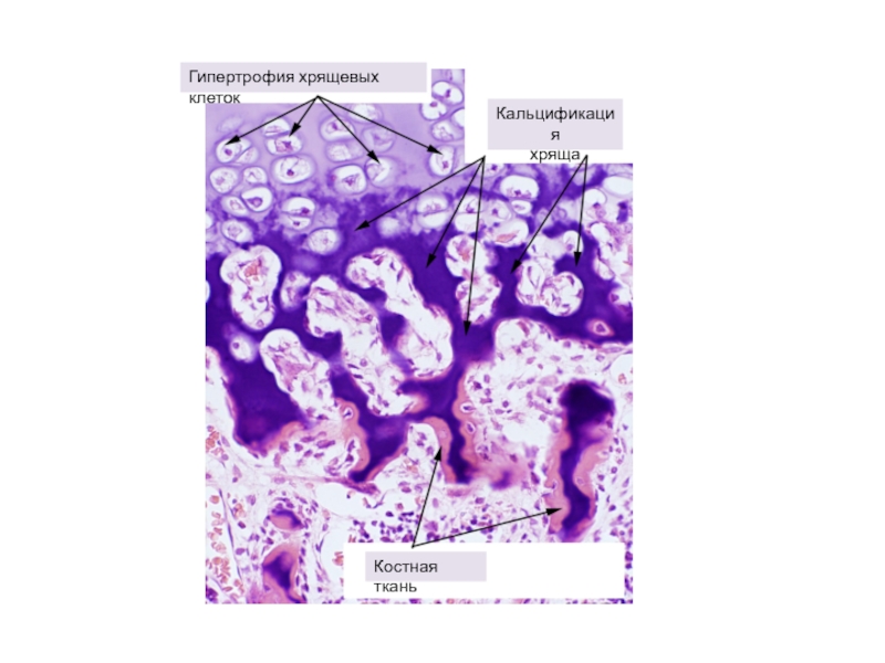 Развитие кости на месте хряща гистология рисунок