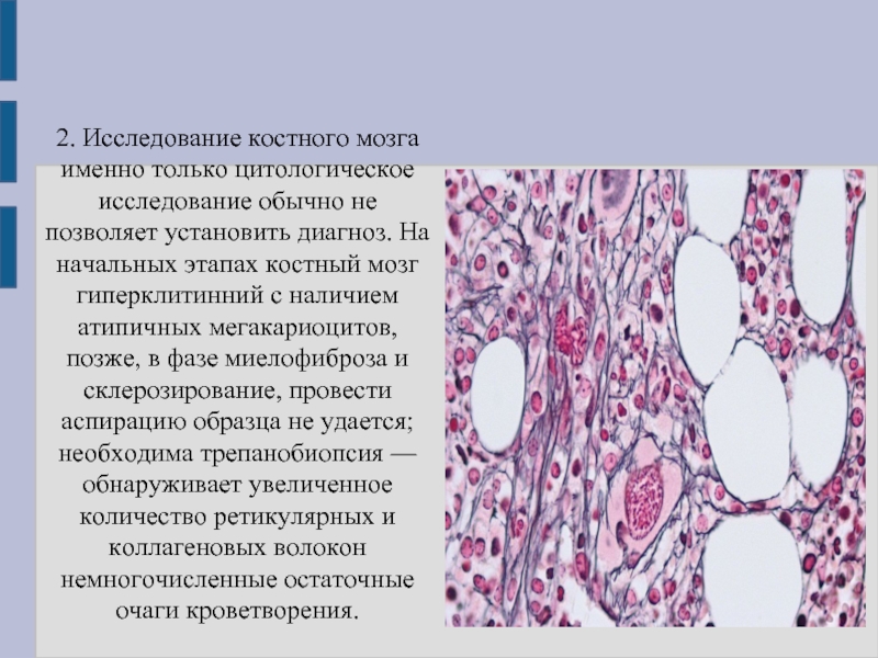 Исследование костной ткани