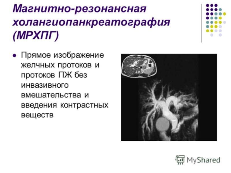 Мрхпг это. Магнитно-резонансная холангиопанкреатография при ЖКБ. Холангиография жёлчных протоков. МРХПГ поджелудочной железы. Магнитно резонансная холангиопанкреатография МРХПГ.