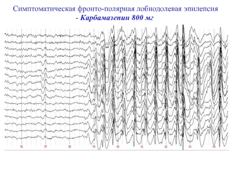 Учебный план электроэнцефалография