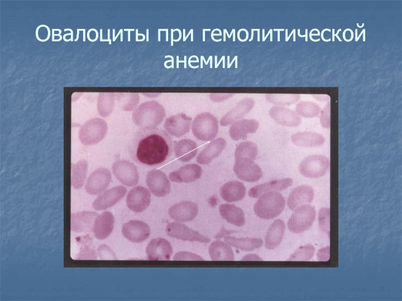 Патология системы крови презентация