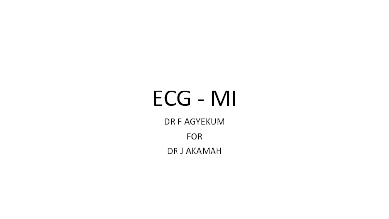 ECG - MI