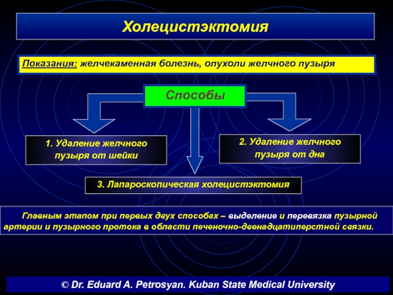 Реферат: Холецистектомия