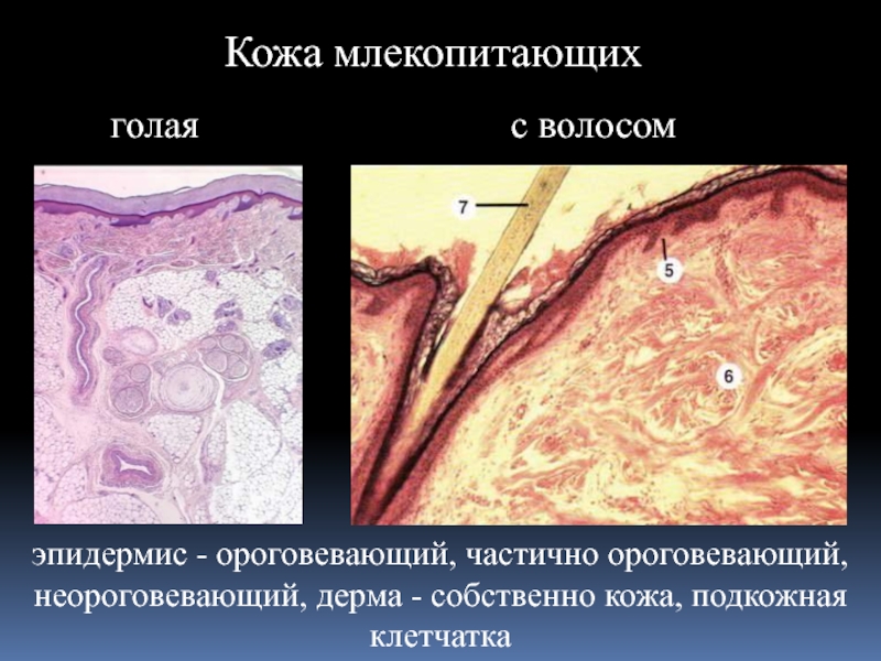 Кожная сенсорная система презентация