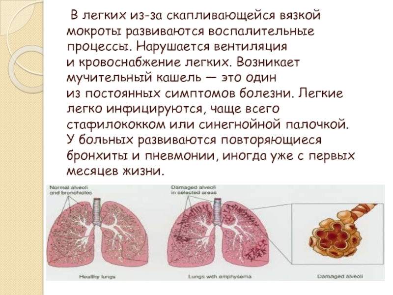 Тест нмо кистозный фиброз муковисцидоз по утвержденным