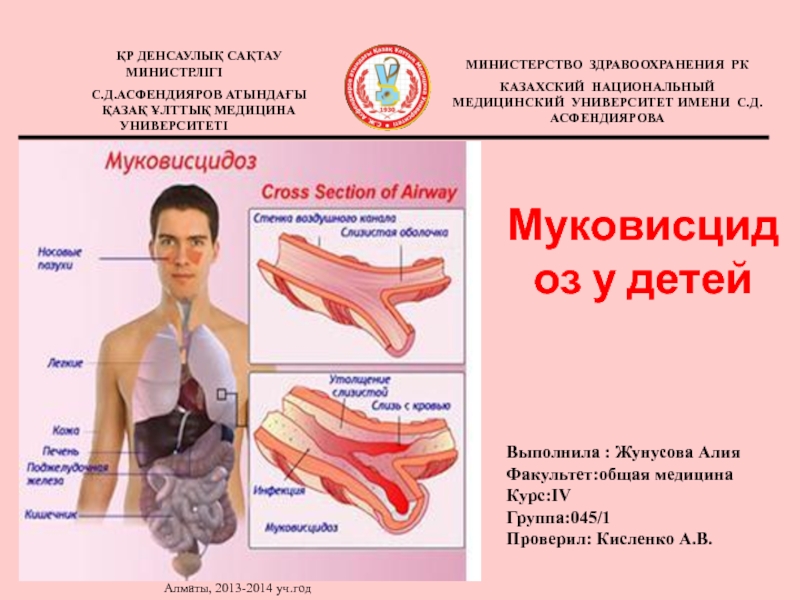 Муковисцидоз у детей
Алматы, 2013-2014 уч.год
ҚР ДЕНСАУЛЫҚ САҚТАУ