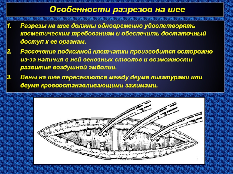 Особенности разреза. Схема разрезов в области шеи. Земля в разрезе схема. Уравномер схема в разрезе.