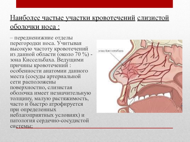 Носовое кровотечение презентация лор