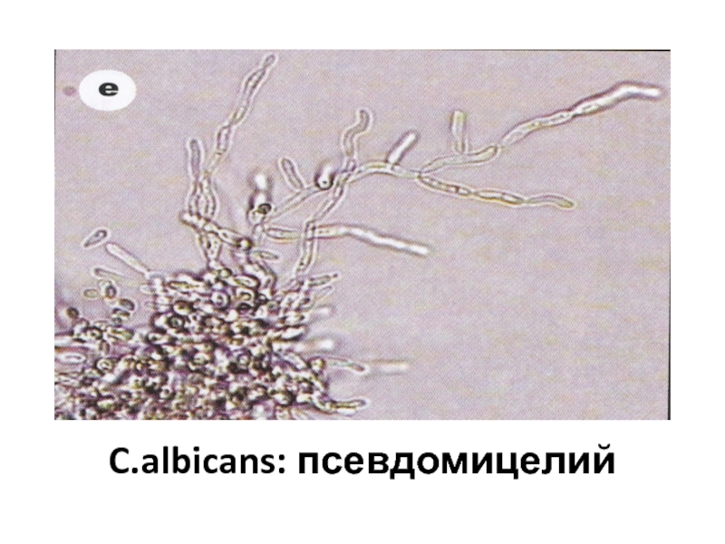 Нити мицелия споры. Псевдомицелий кандида. Псевдомицелий гриба рода Candida. Грибы кандида микроскопия. Нити мицелия микроскопия.