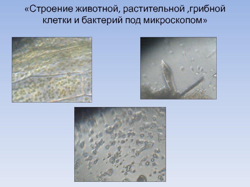 Микропрепарат бактерий. Строение клетки гриба под микроскопом. Грибная клетка под микроскопом. Строение клетки бактерии под микроскопом. Строение бактерии под микроскопом.
