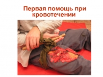 ПЕРВАЯ ПОМОЩЬ ПРИ КРОВОТЕЧЕНИИ И ТРАВМАТИЧЕСКОМ ШОКЕ.ppt