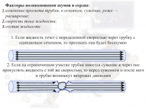 Факторы возникновения шумов в сердце :
изменение просвета трубки, в основном,