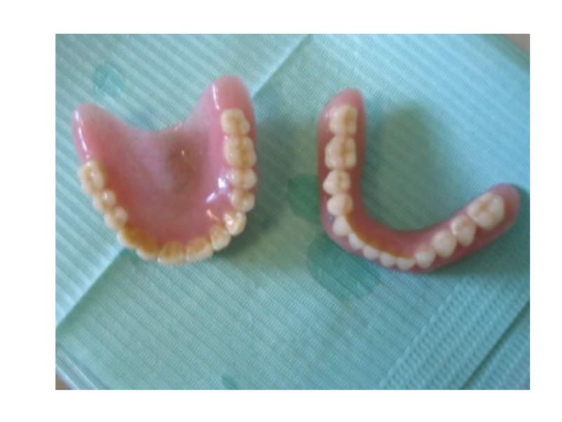 Патология твердых тканей. Аномалии твердых тканей зубов. Твердые ткани зуба некариозного происхождения. Патология твердых тканей зубов некариозного происхождения. Твёрдых тканей зуба кариозногои некариозного происхождения.