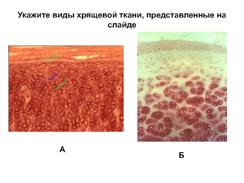 Хрящевая ткань презентация