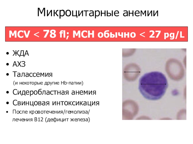 Mch анемия. Анализ крови при сидеробластной анемии. Патогенез сидеробластной анемии. Анемии по MCV MCH. Микроцитарная нормохромная анемия.