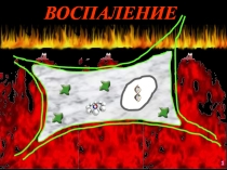 ВОСПАЛЕНИЕ