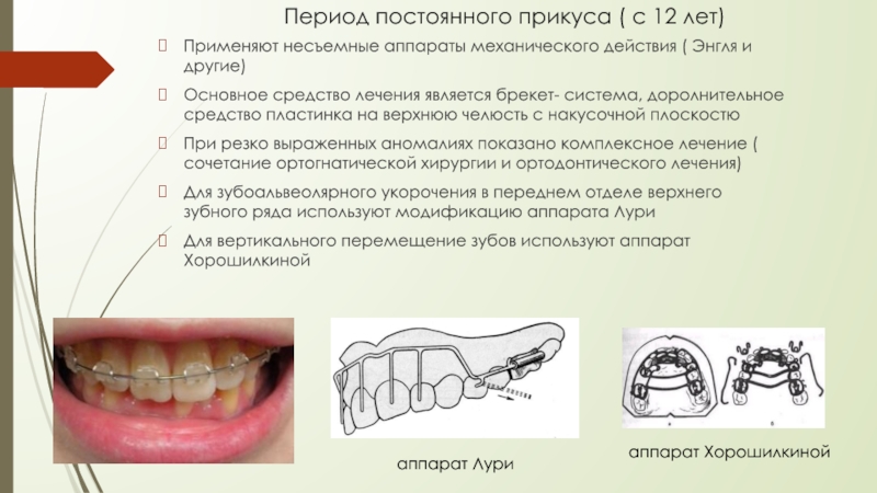 Ортодонтические аппараты механического действия презентация