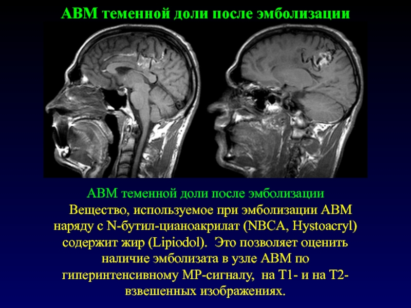 Мр картина авм