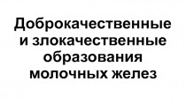 Доброкачественные и злокачественные образования молочных желез