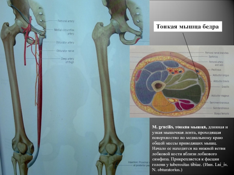 Мышцы бедра тонкая мышца