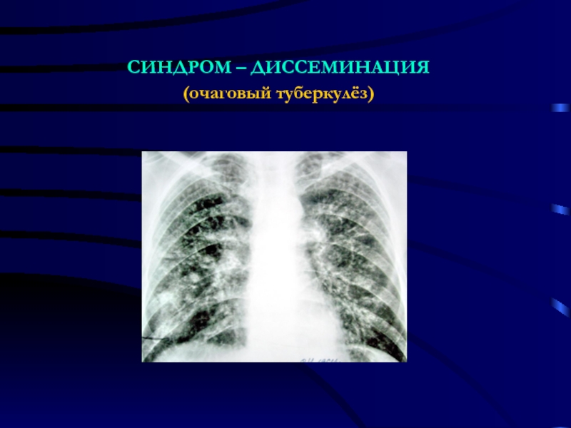 Лучевая диагностика средостения презентация