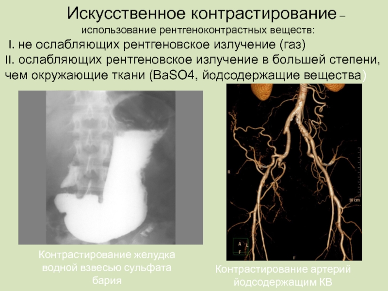 Методы контрастирования изображения