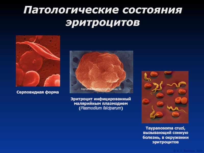 Физиология эритроцитов презентация