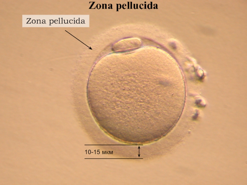 Ооцит размер. Яйцеклетка человека. Полярное тельце в яйцеклетке. Оболочки яйцеклетки. Строение яйцеклетки человека.